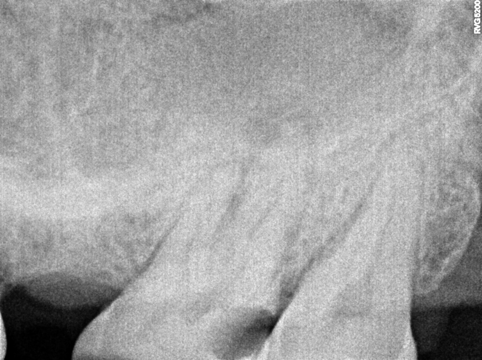 Dental X-ray